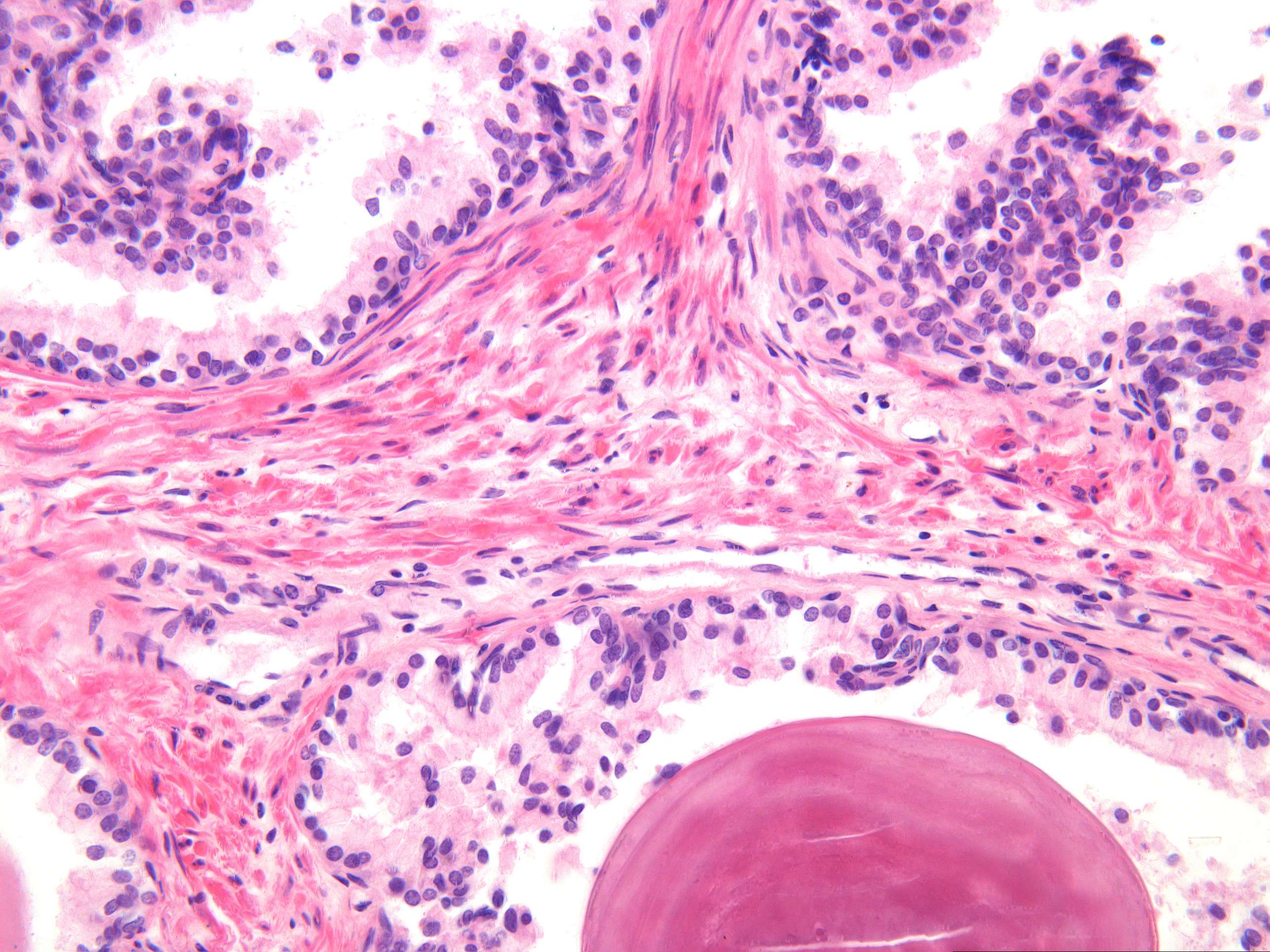 Microimage