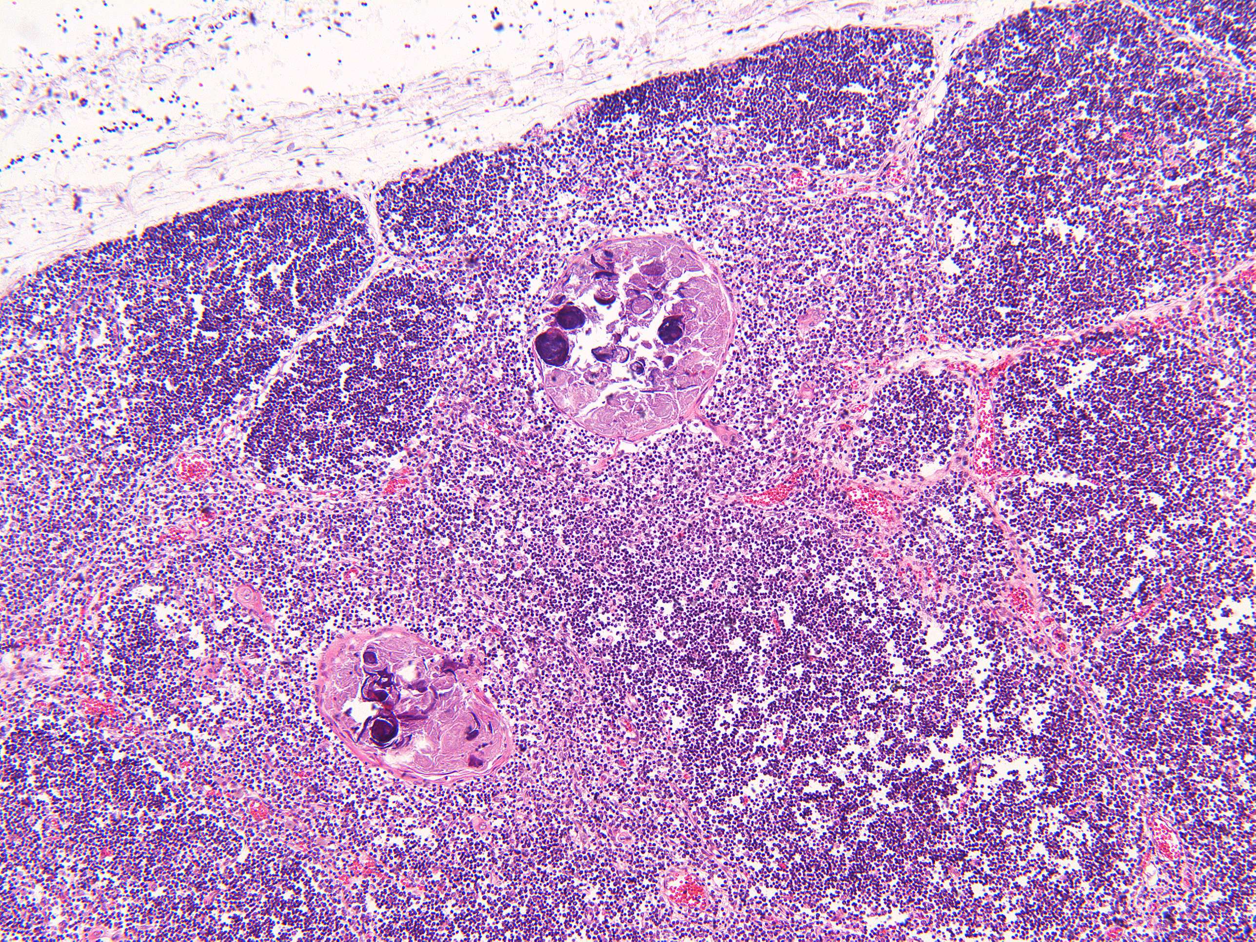 Microimage