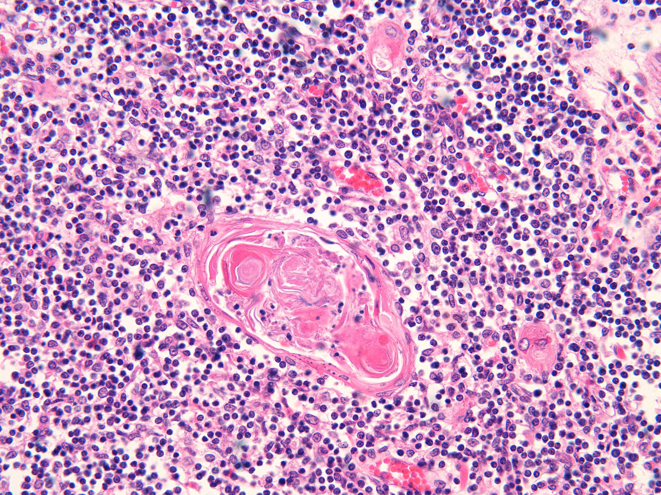 Microimage