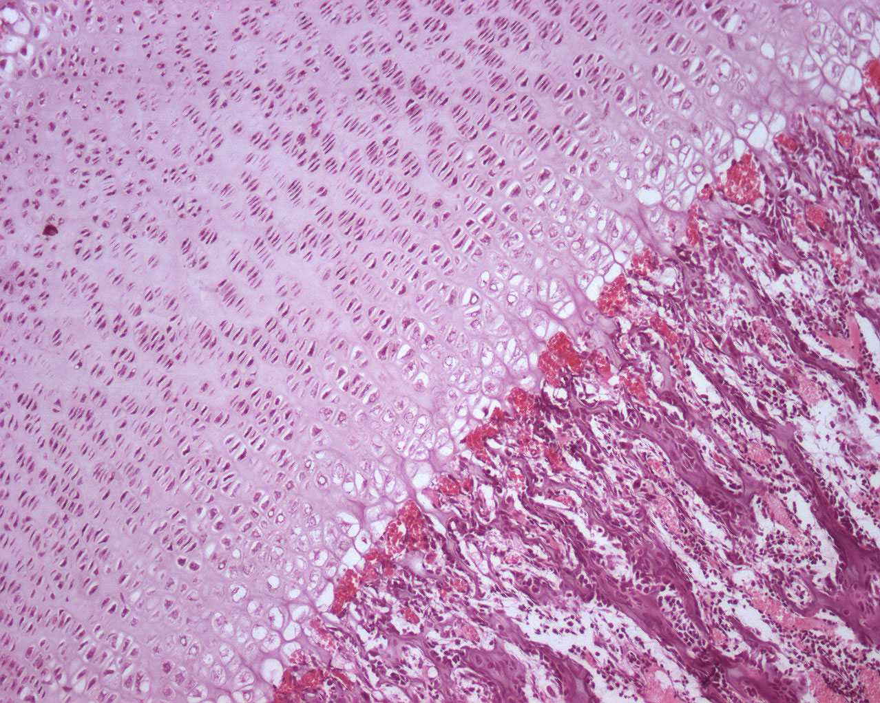 endochondral ossification histology